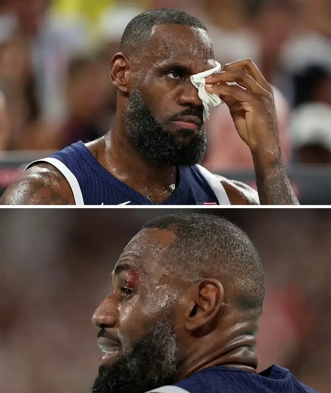 法国杯倒计时；纽卡斯尔冲刺阶段伤情更新；细节引发关注；更衣室稳定；轮换策略成焦点的简单介绍